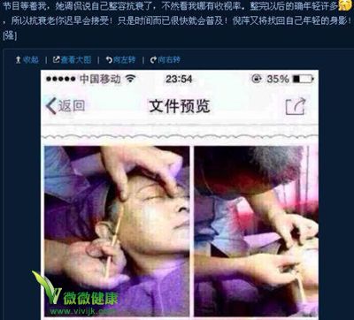 网曝倪萍“或为重返央视”注射除皱