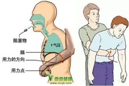 一分钟教你吐出被卡鱼刺