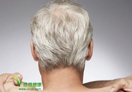 白发位置不同 暗示不同的健康问题 