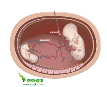 孕产保健与你分享胎宝宝心情日记