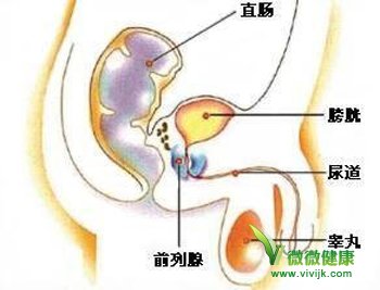 前列腺检查的几种检查方法