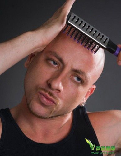 5大法则解决男士秃头困扰
